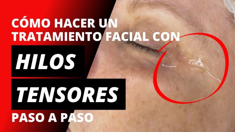 como se colocan los hilos tensores en la cara