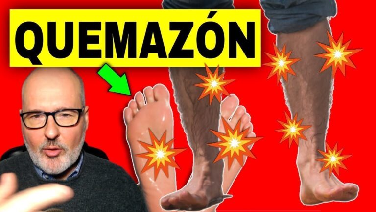 sensacion de que te queman los pies